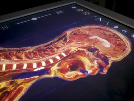 Anatomage Table